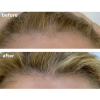 Hair Serum - Keratinocyte Growth Factor - Skin Actives - 4.0 oz.